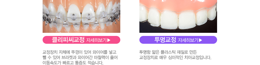 통증이 덜한 교정을 원한다면?