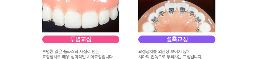 티 안나는 교정을 원한다면?
