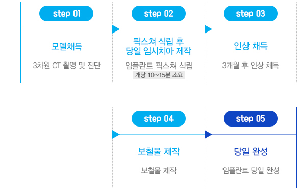 당일즉시 임플란트 치료과정