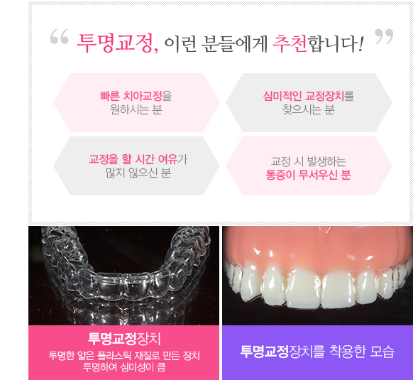 투명교정 치료대상