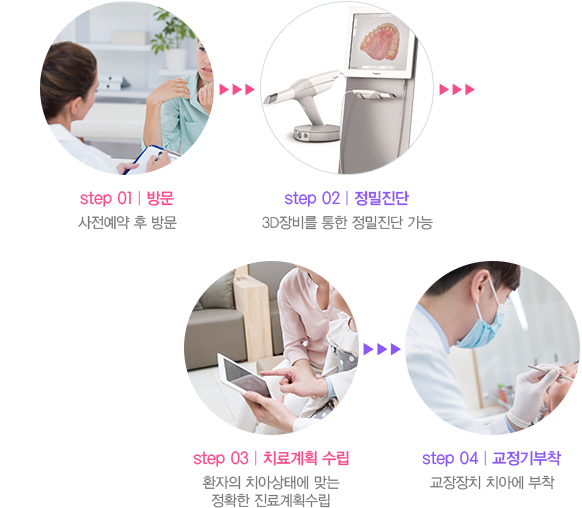 투명교정 장비시스템