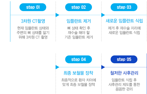 재수술 임플란트 치료과정