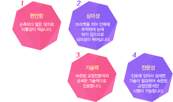 설측교정 장점
