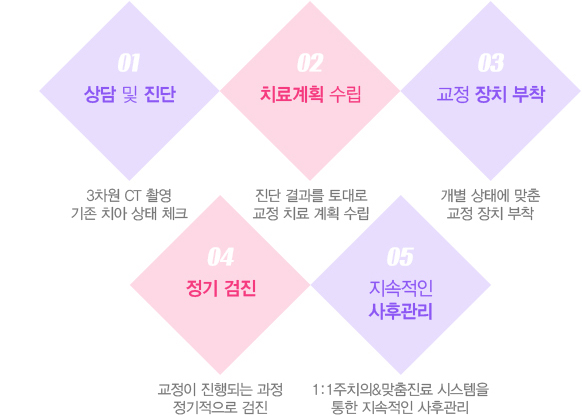 설측교정 치료과정